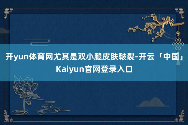 开yun体育网尤其是双小腿皮肤皲裂-开云「中国」Kaiyun
